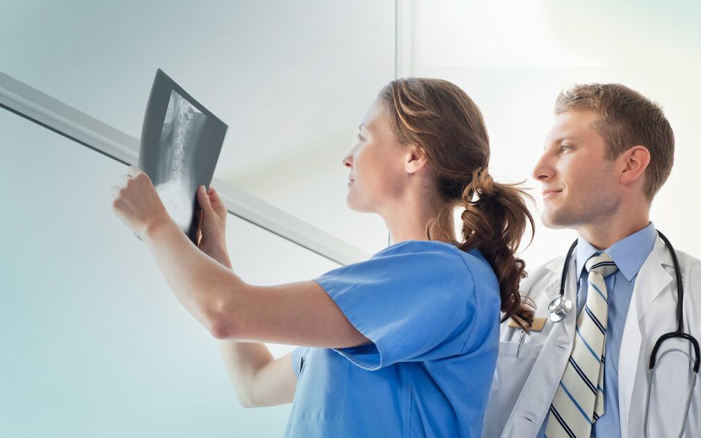 lékaři při pohledu na rentgen pro artrózu